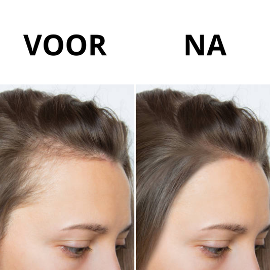 haargroei stimuleren door voeding en natuurlijke supplementen